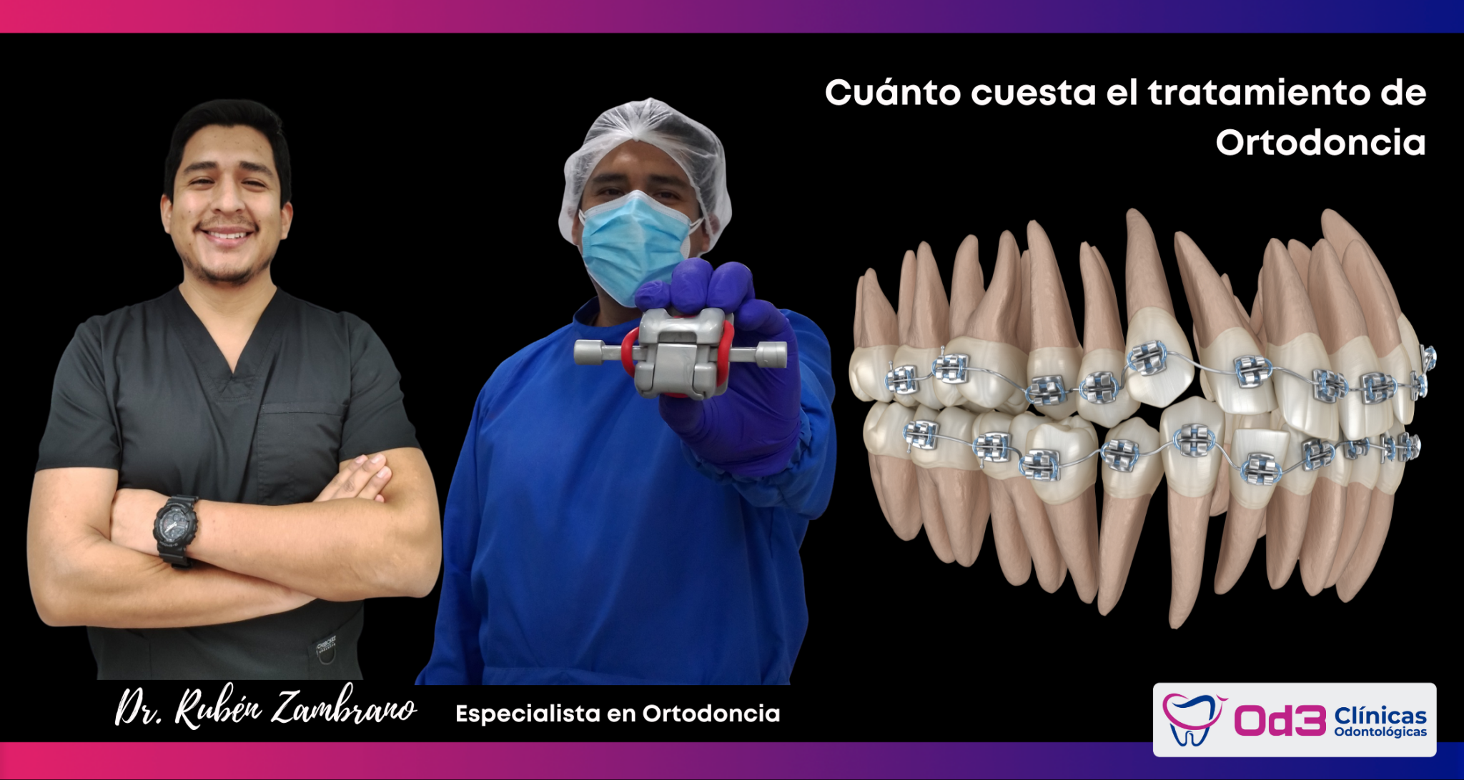 Cuánto cuestan los Brackets en Lima 2022? diciembre 2022