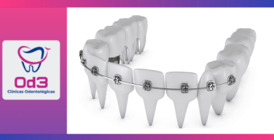 PRECIO BRACKETS LIMA