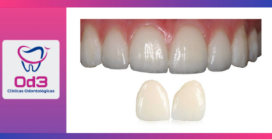 ESTETICA DENTAL LIMA