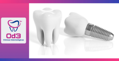 IMPLANTES DENTALES LIMA