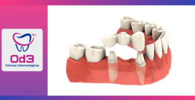 PROTESIS DENTAL LIMA
