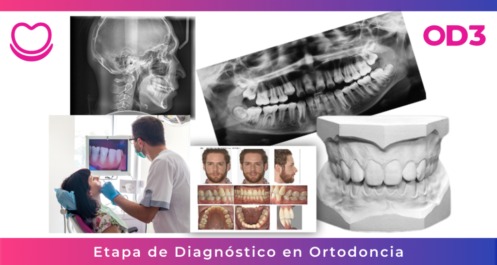 Etapas en Ortodoncia
