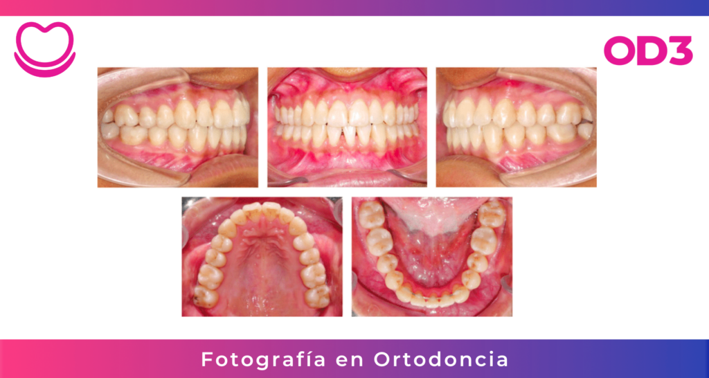 Fotografías en Ortodoncia