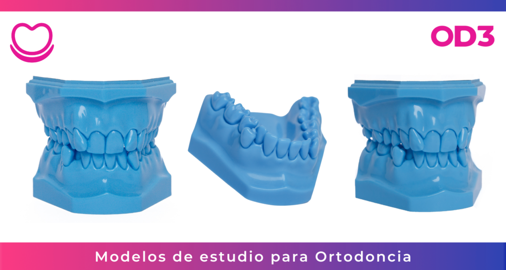 Modelos de estudio para Ortodoncia